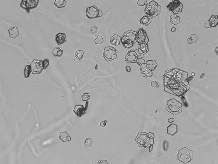 cristales de cistina en perros - Qué significa la presencia de cristales de cistina en orina