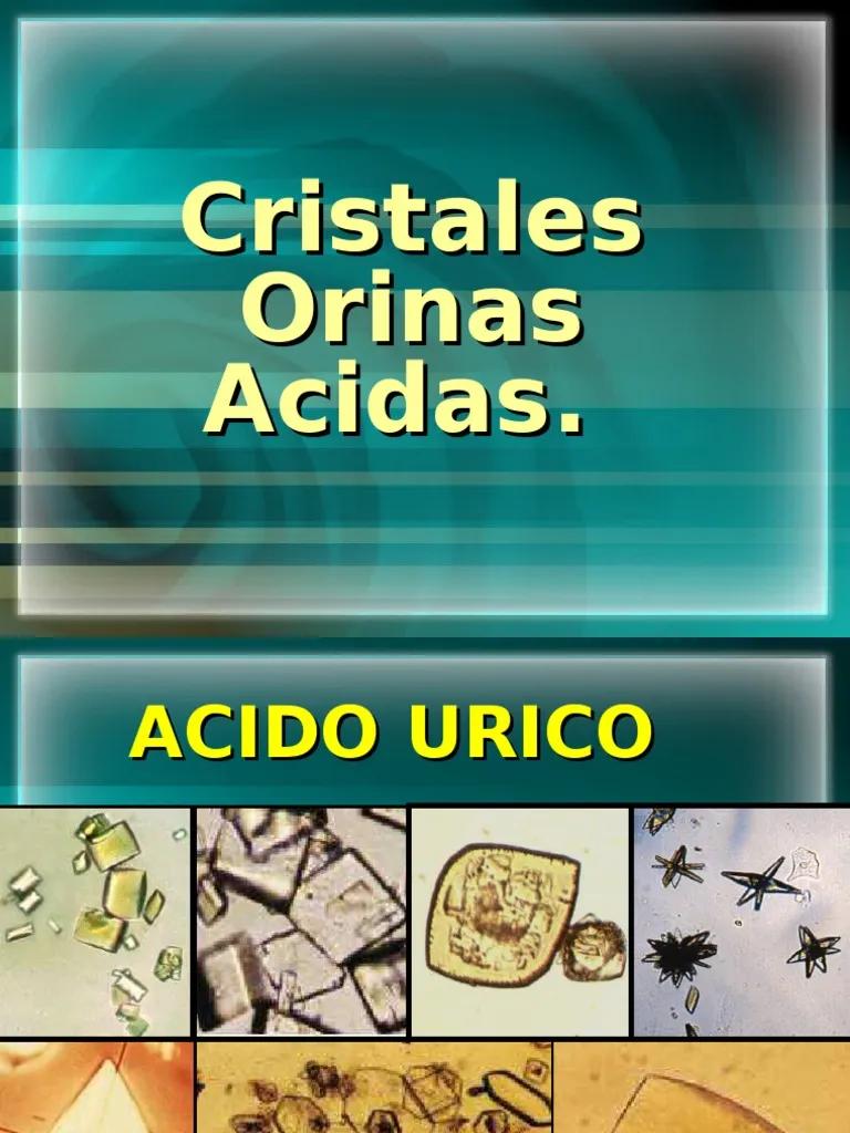 cristales en orina acida - Qué tipo de cristales se pueden encontrar en orinas ácidas y en orina alcalinas